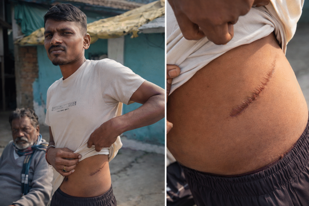 Kidney Racket Investigation